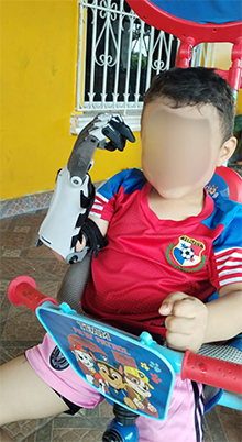 niño pro tesis cara tapada